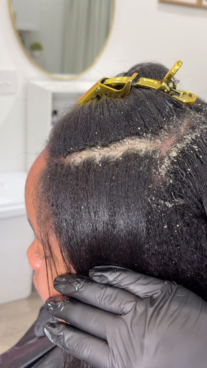 Person receiving a grainy scalp scrub treatment with a gloved hand applying it.